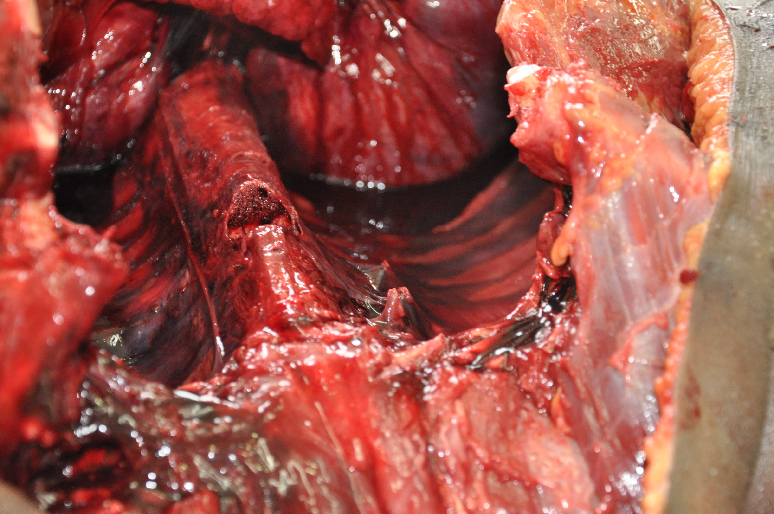 Blunt Force Injuries 10