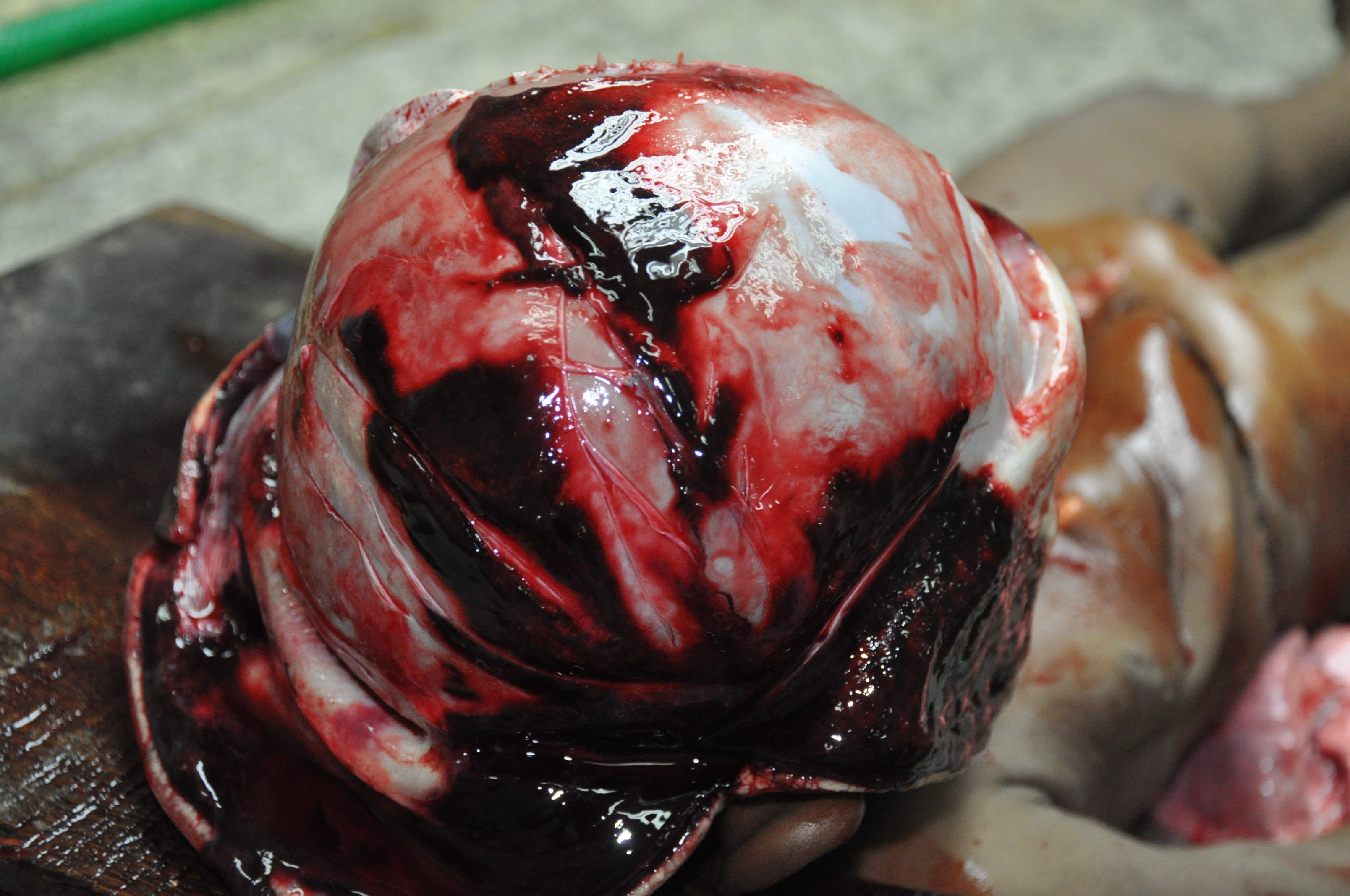 Blunt Force Injuries 12