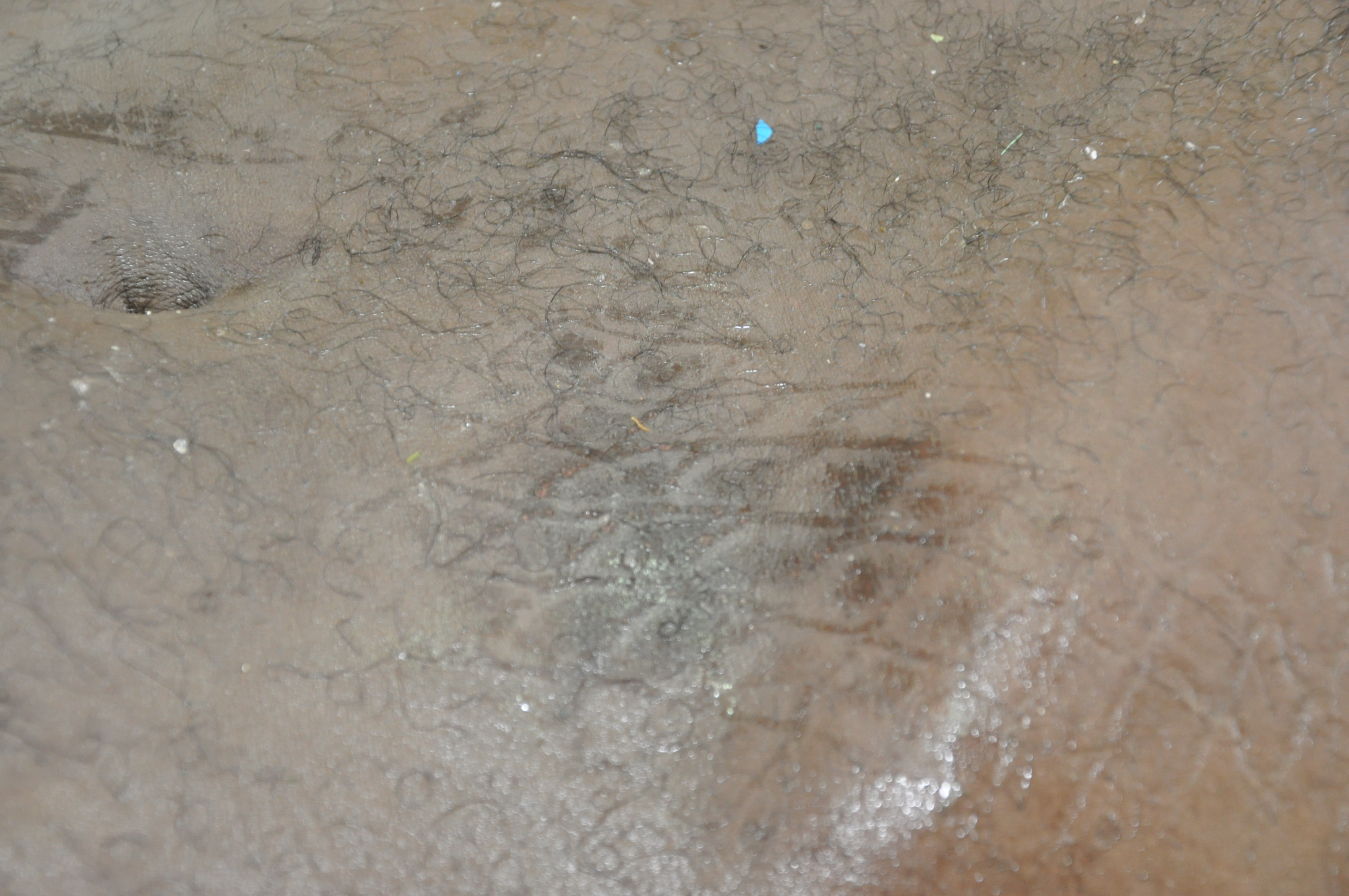 Blunt Force Injuries 2