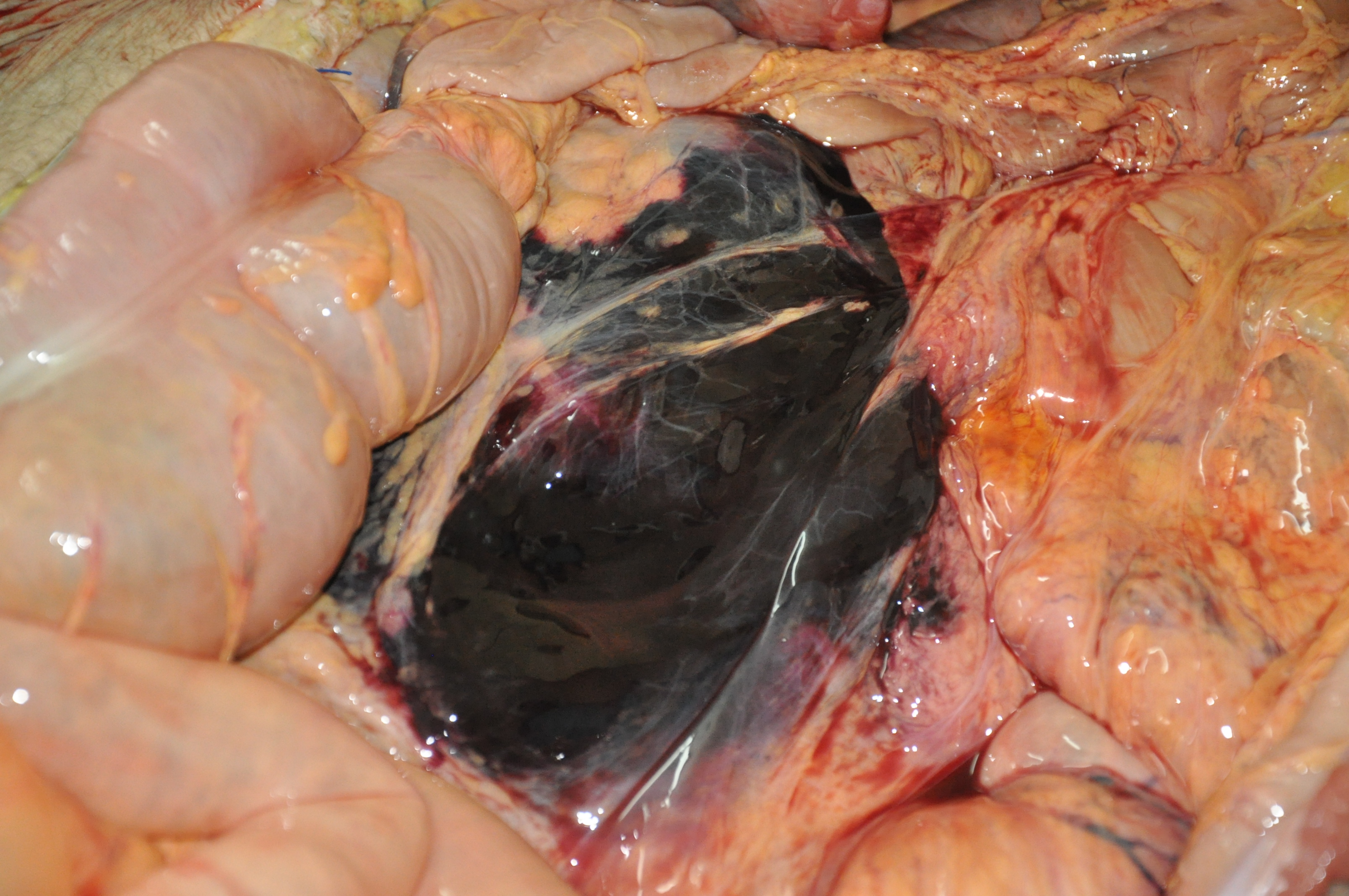 Blunt Force Injuries 4