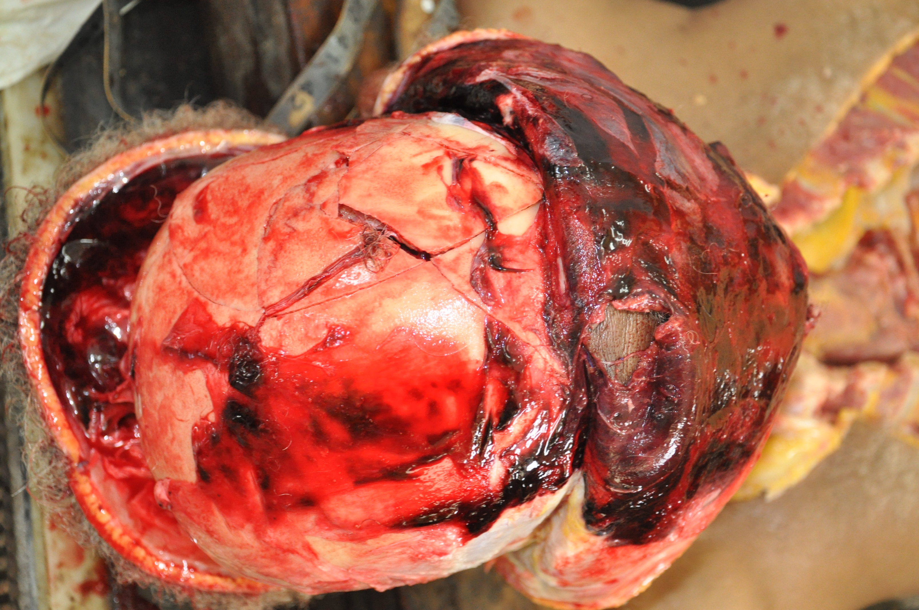 Blunt Force Injuries 8