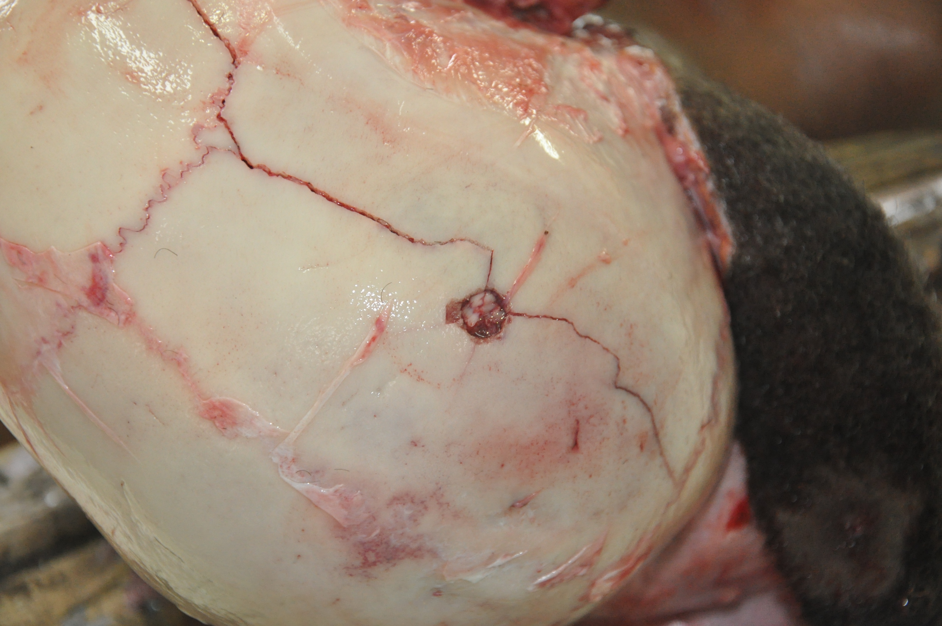 Blunt Force Injuries 9