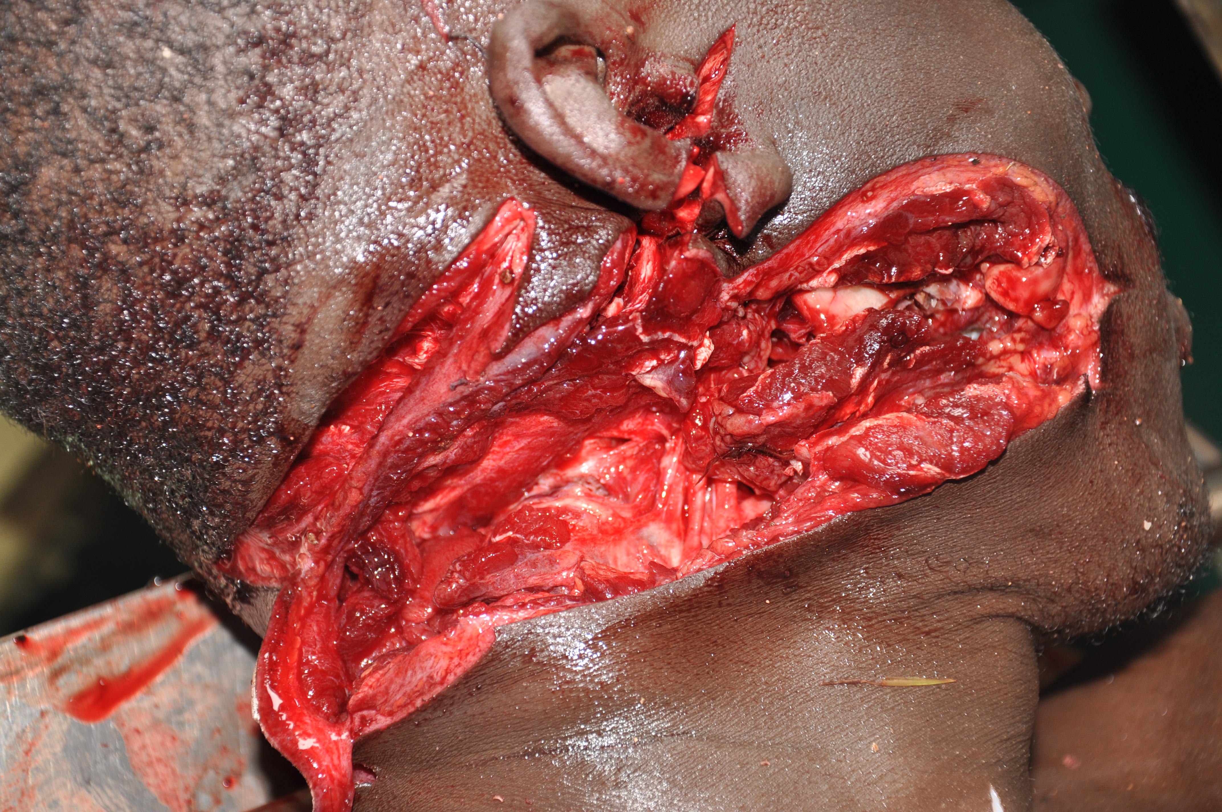 Sharp Force Injuries 12