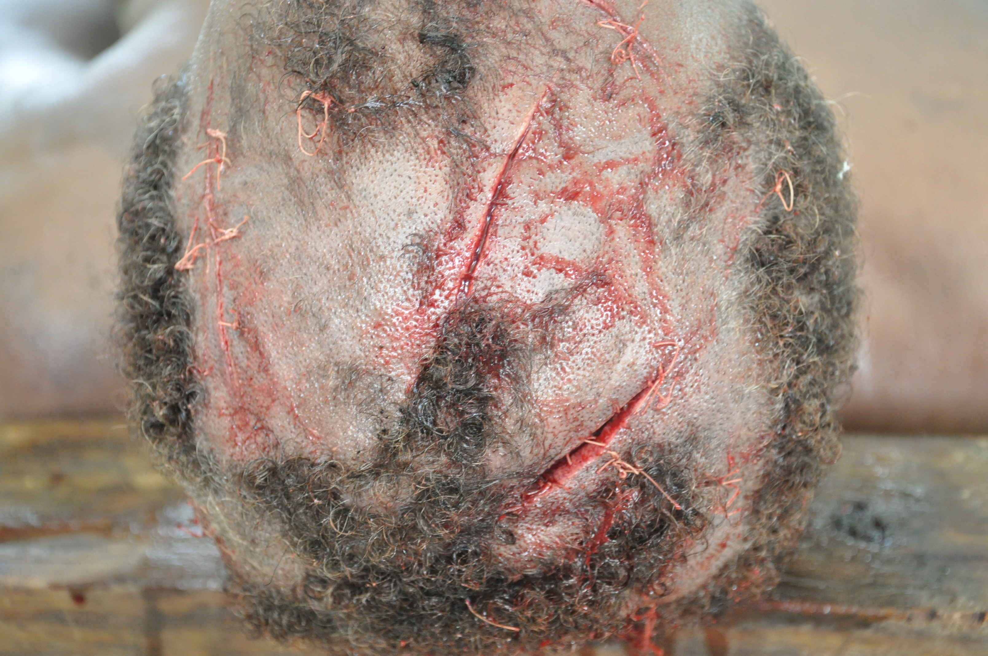 Sharp Force Injuries 2