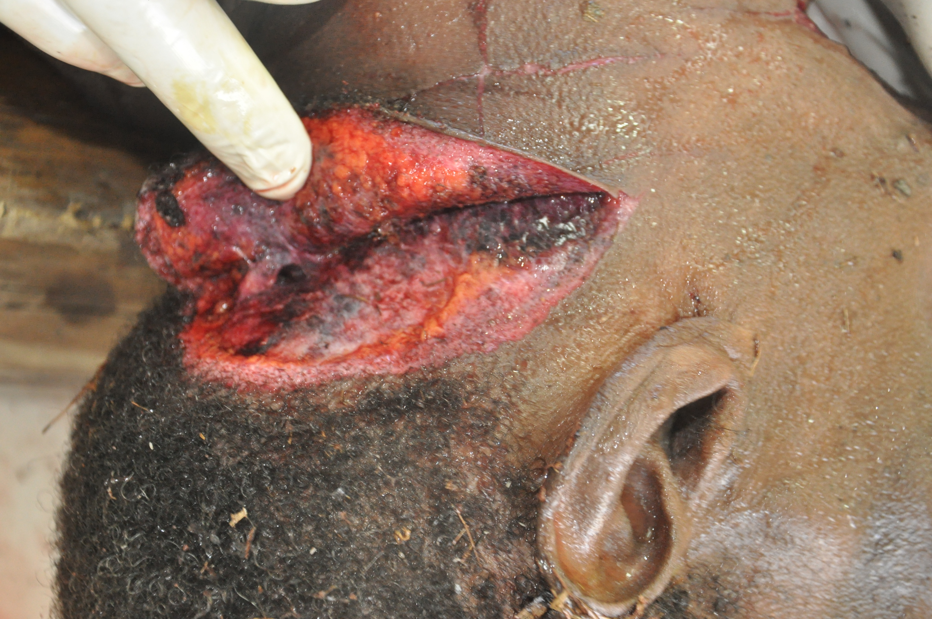 Sharp Force Injuries 9