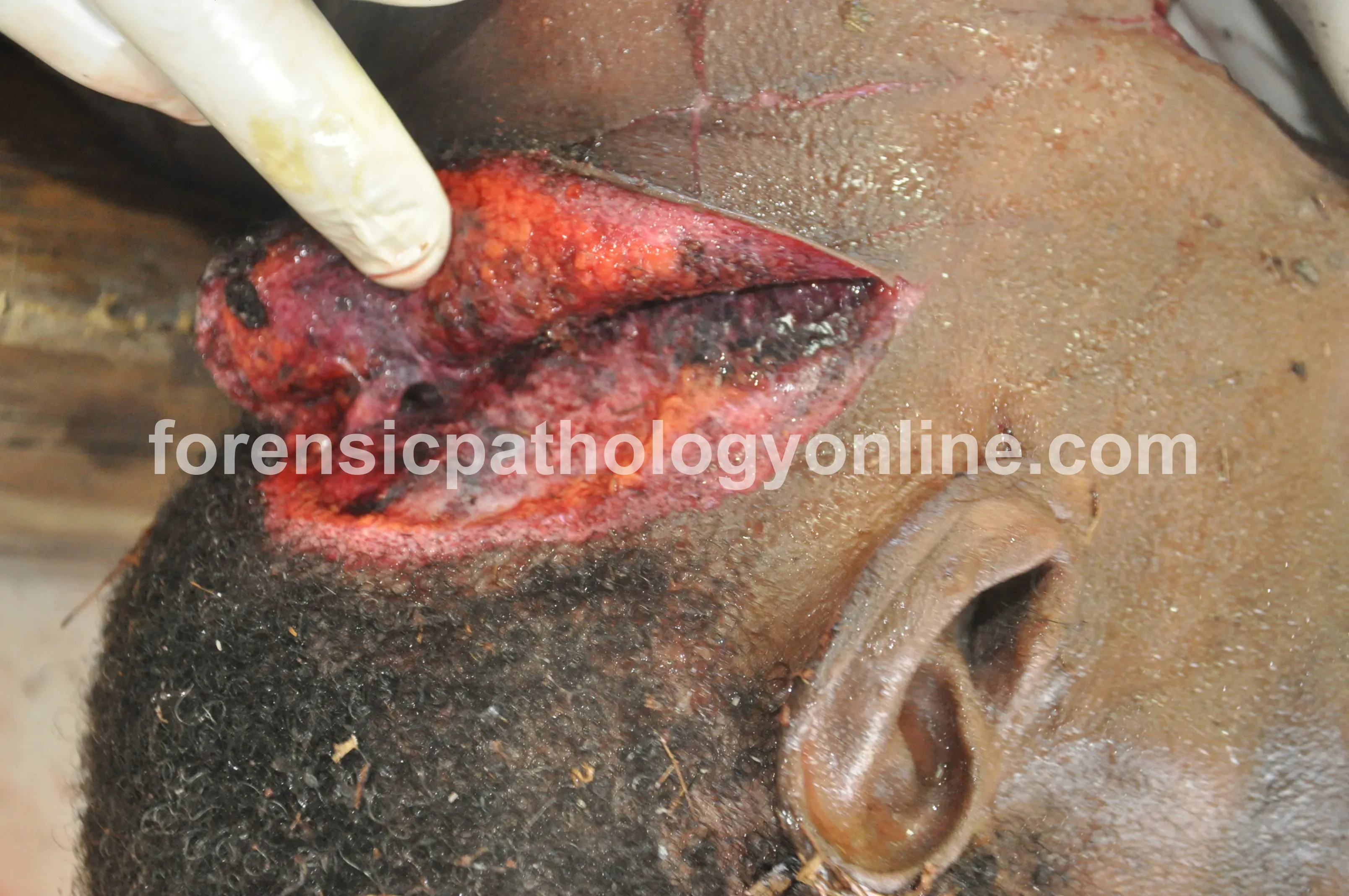 Sharp Force Injuries 9